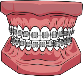 Standard braces