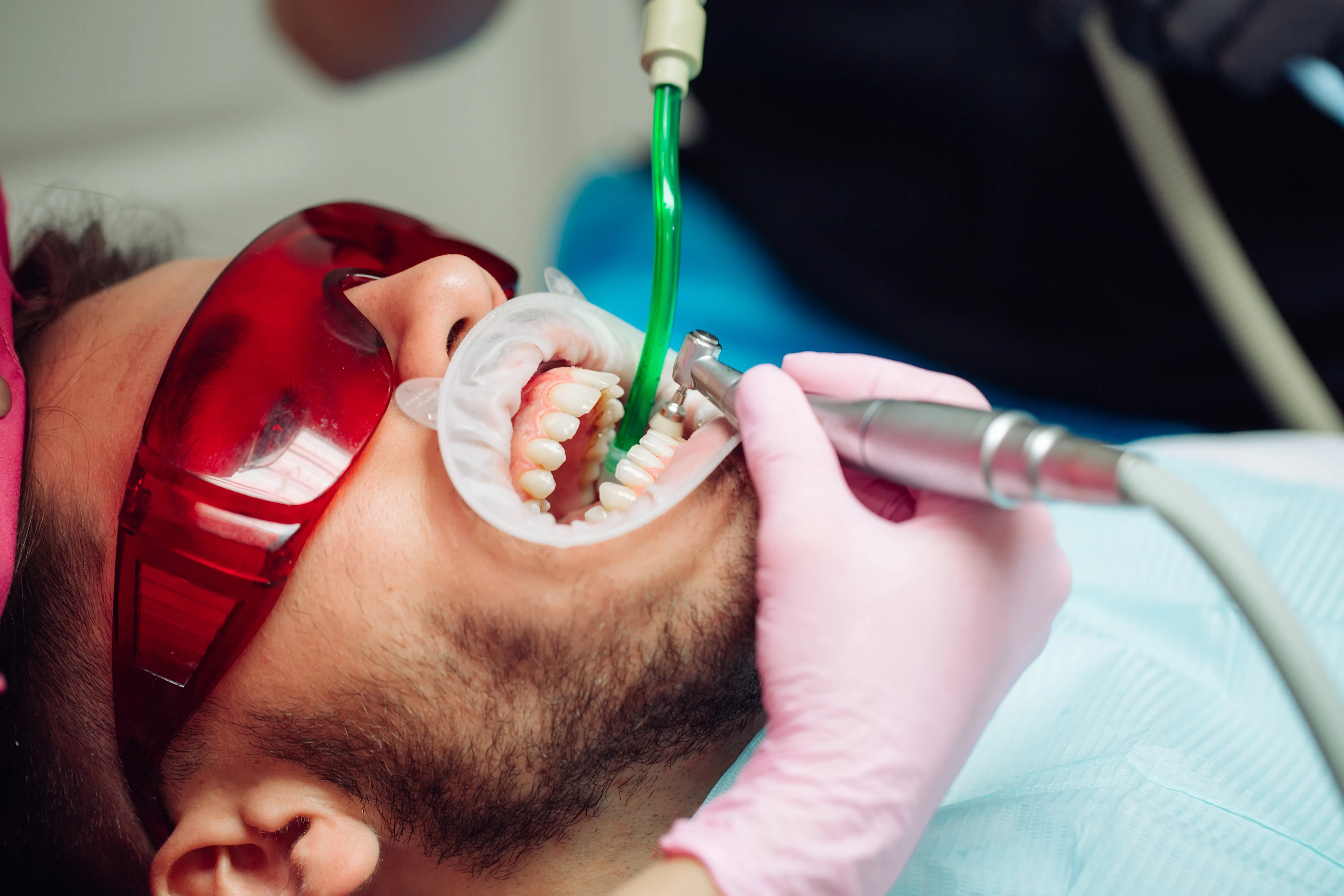 Patient with a cheek retractor receiving a dental cleaning with suction and a handpiece
