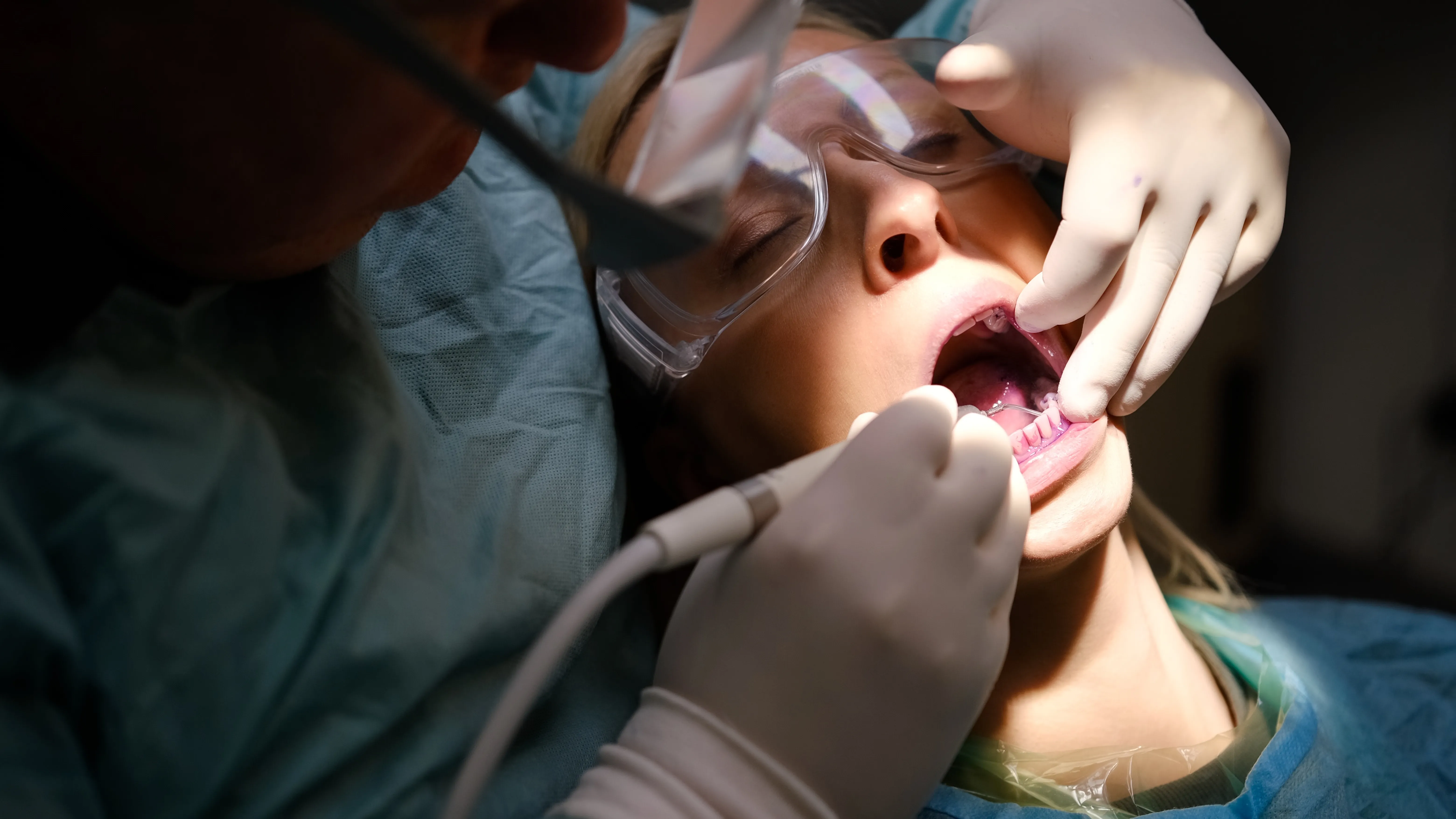 Patient wearing a nasal mask during a dental cleaning procedure
