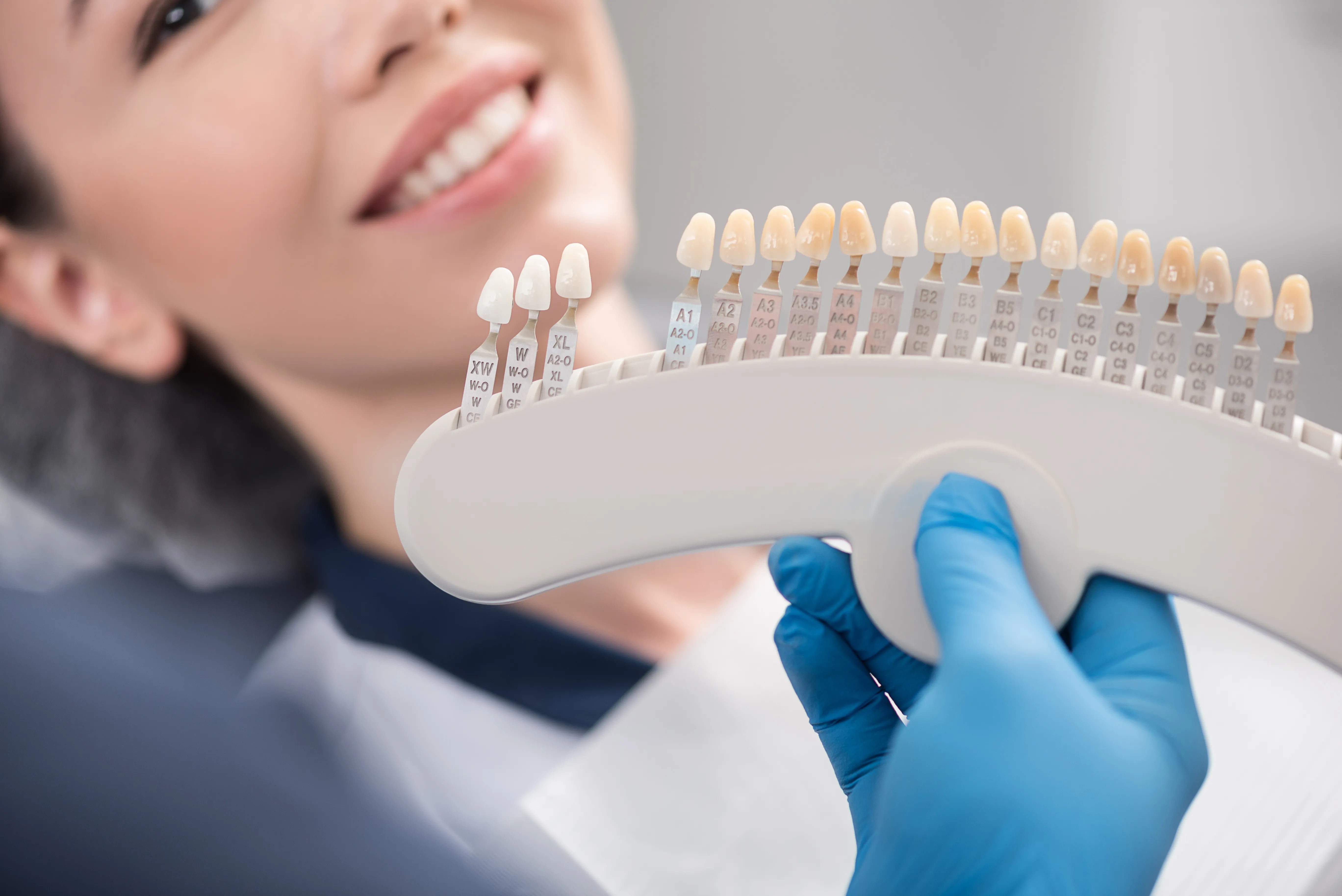 Dentist holding a tooth-shade guide up to a smiling woman's teeth to match veneer or whitening color