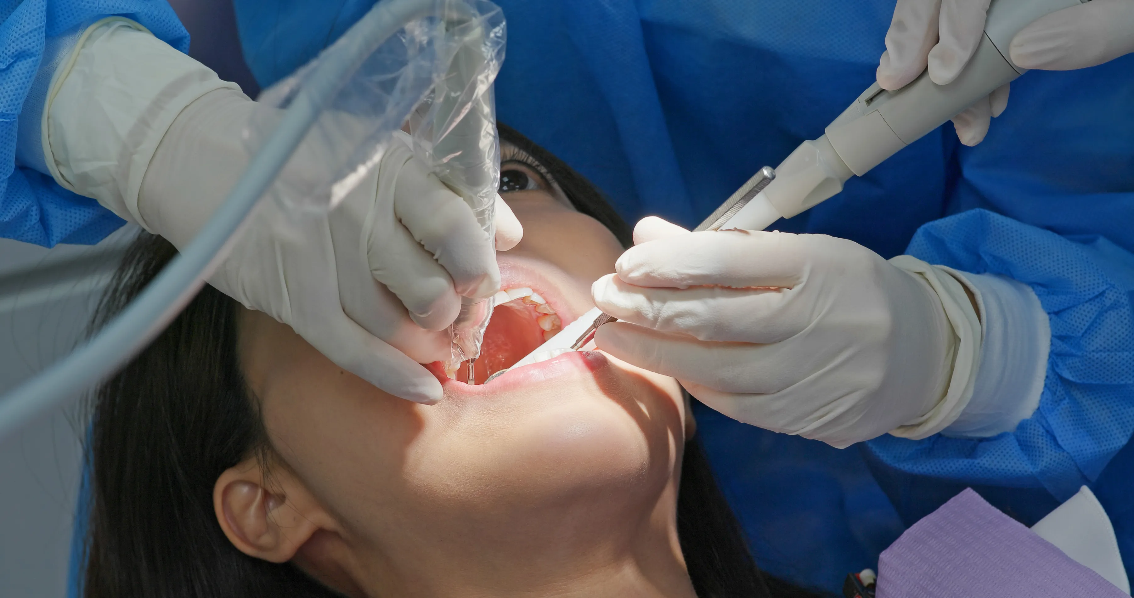Patient reclined with a mouth retractor while two gloved clinicians perform a dental procedure