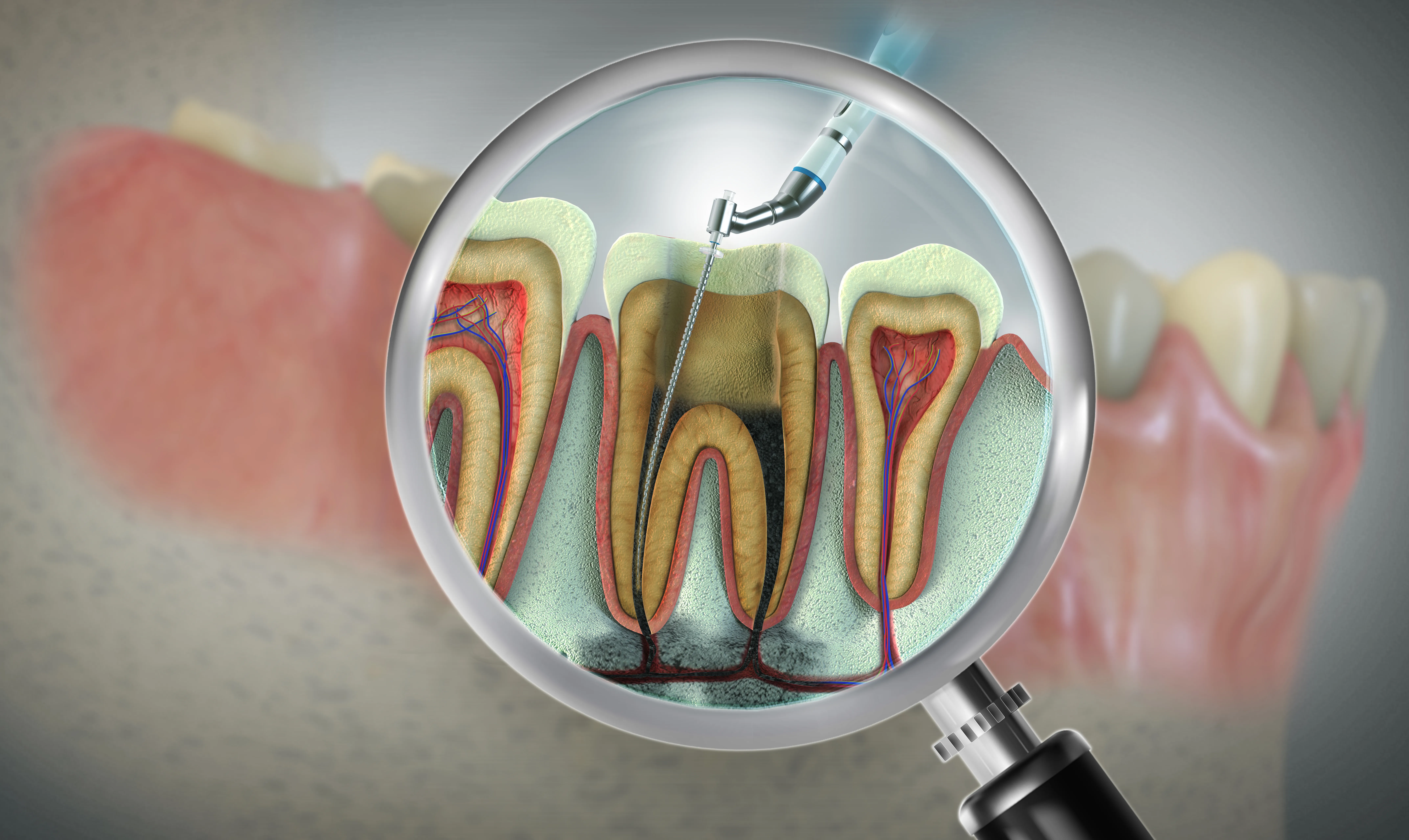3D illustration with a magnifying-glass cutaway revealing the inner root canals and pulp of a tooth