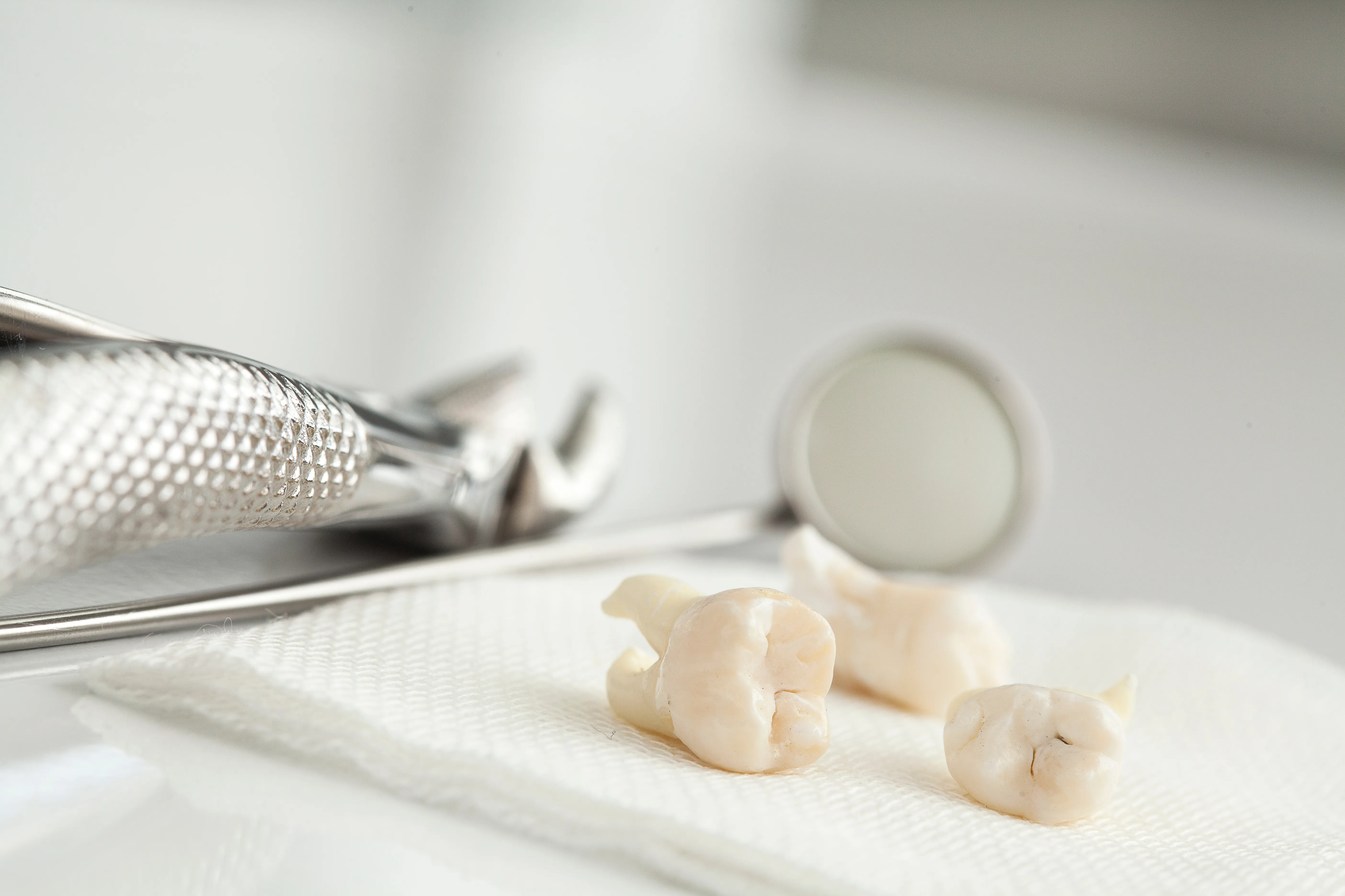 Extracted teeth resting on gauze beside dental forceps and a mouth mirror on a white surface