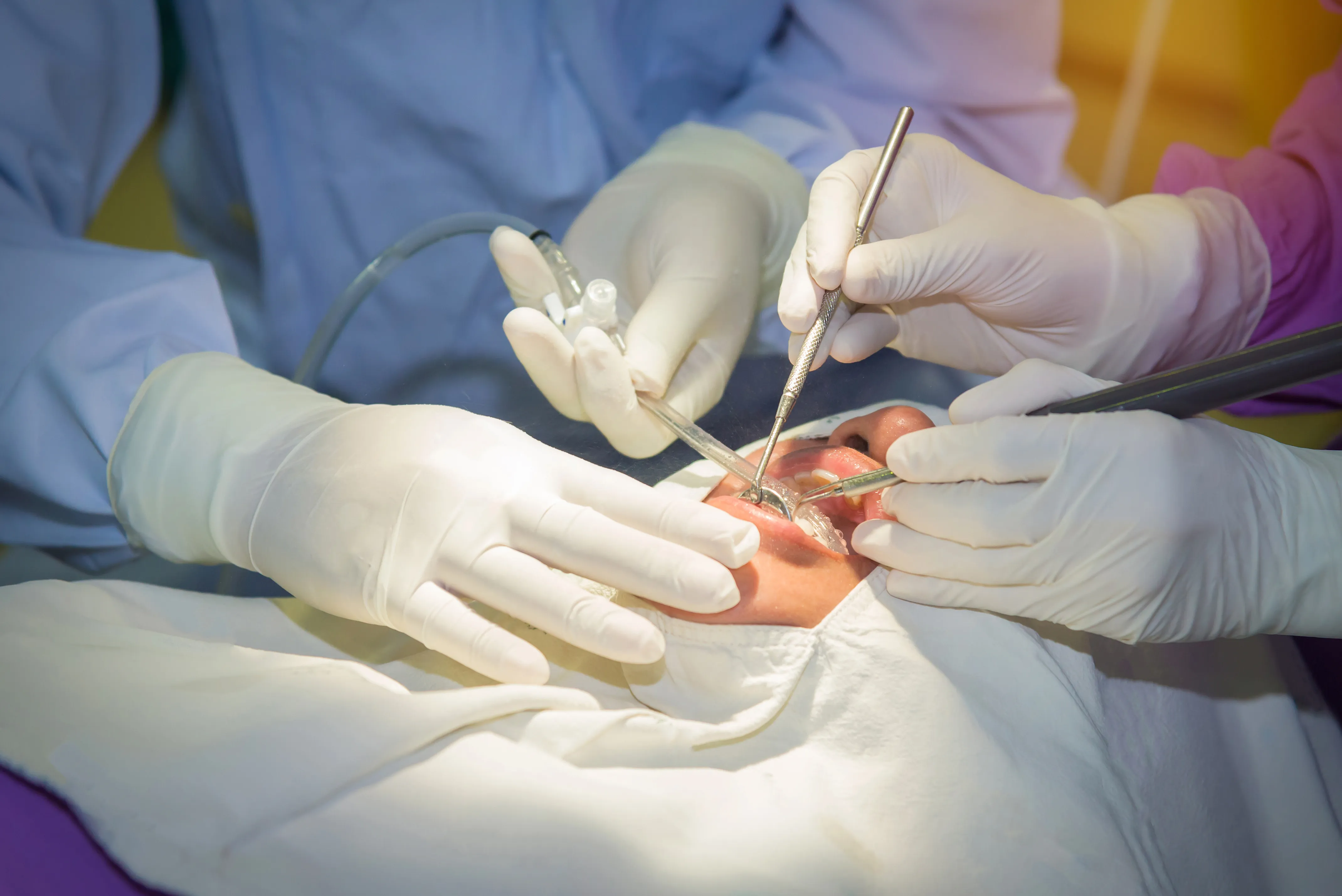Close-up of a dental surgical procedure, with gloved hands using instruments and suction in a patient's mouth