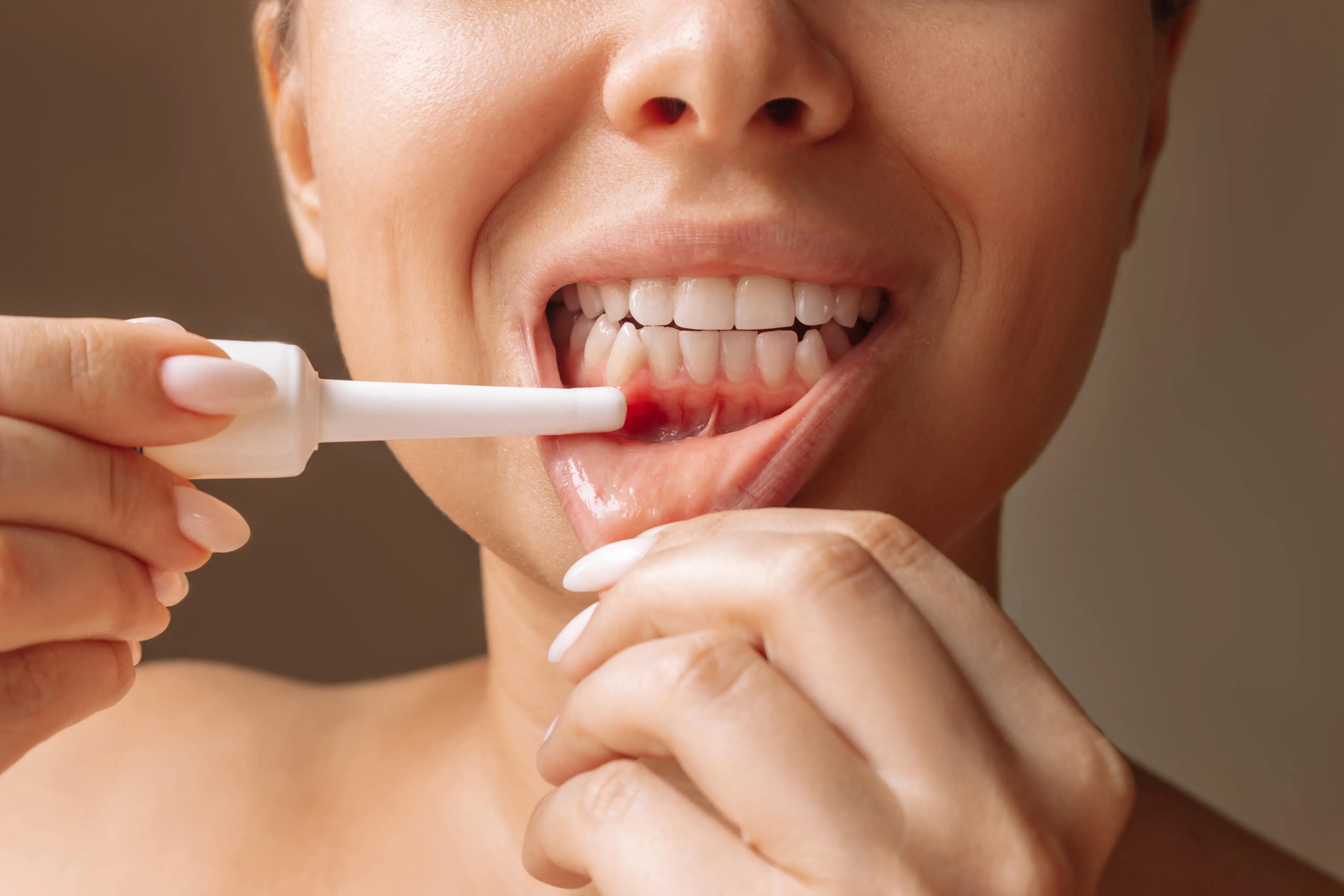 Woman pulling down her lower lip to show inflamed, bleeding gums along her lower front teeth