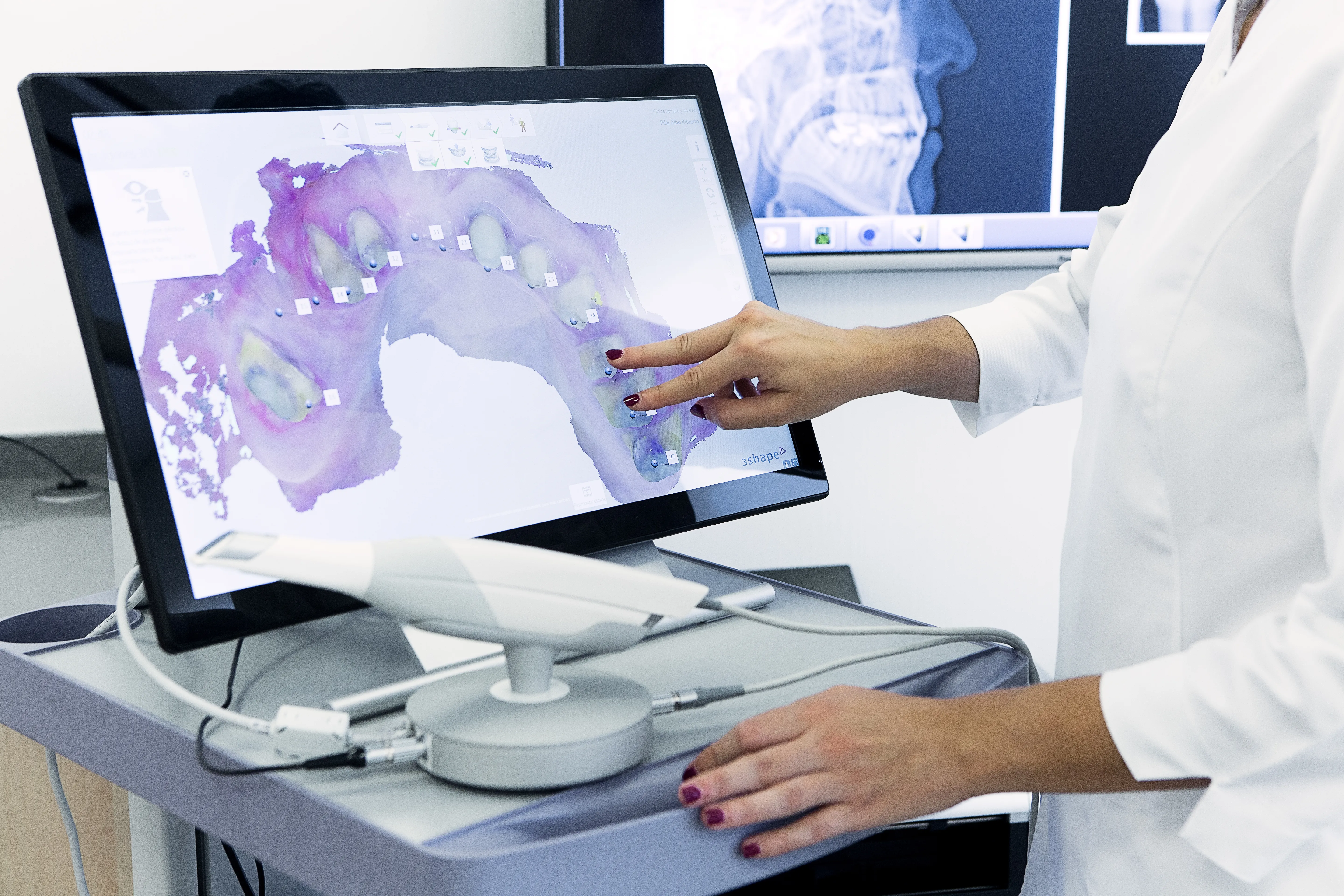 Clinician reviewing a 3D intraoral scan of the dental arches on a chairside monitor