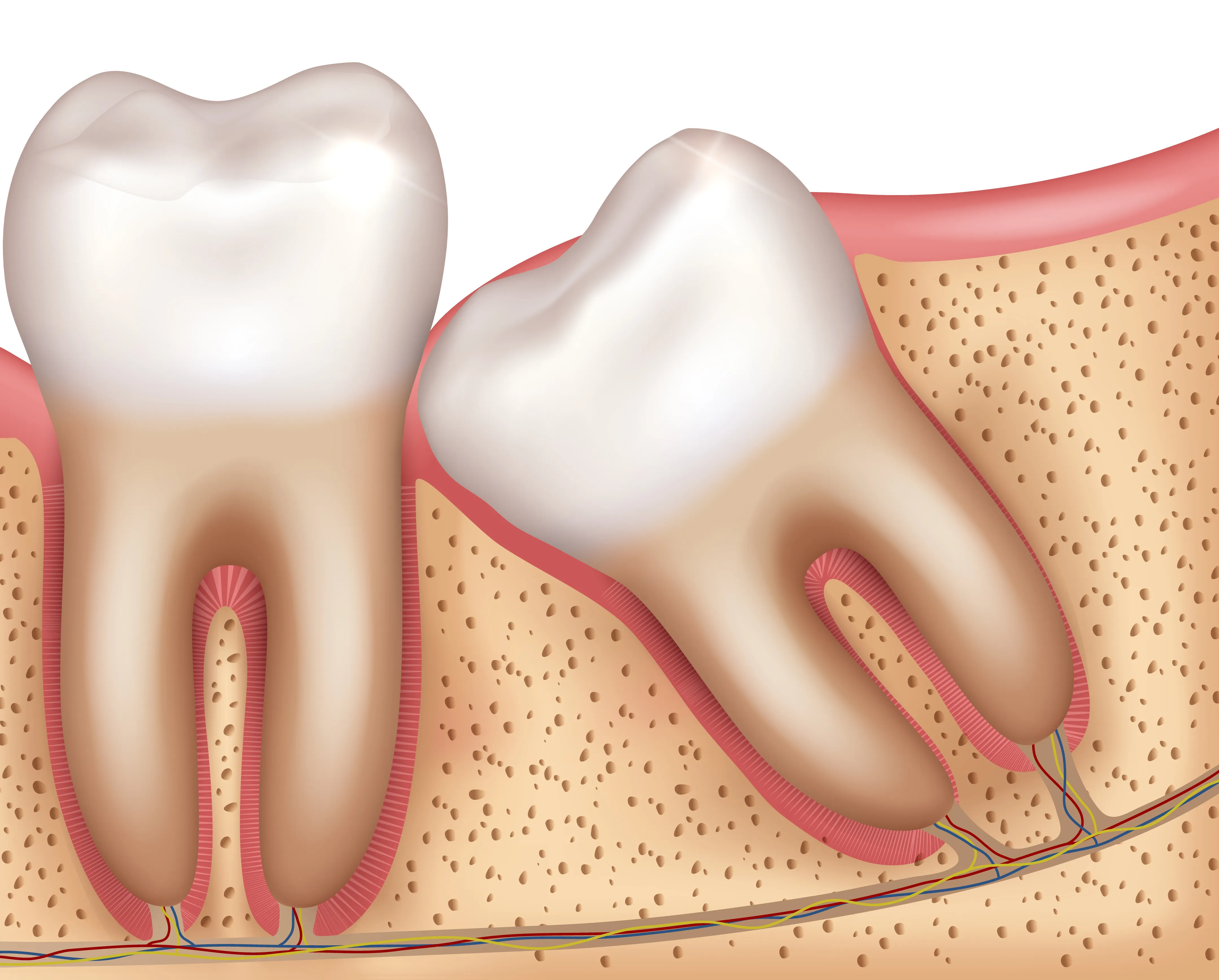 A single extracted multi-rooted tooth resting on white gauze