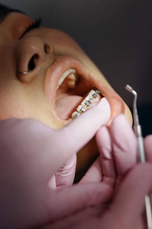 Dentist examining a patient's braces during a dental appointment