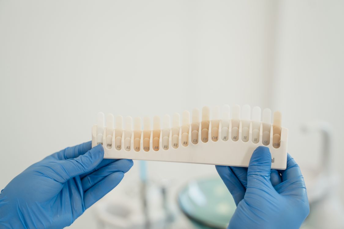 Dentist comparing tooth shades during a cosmetic dental evaluation