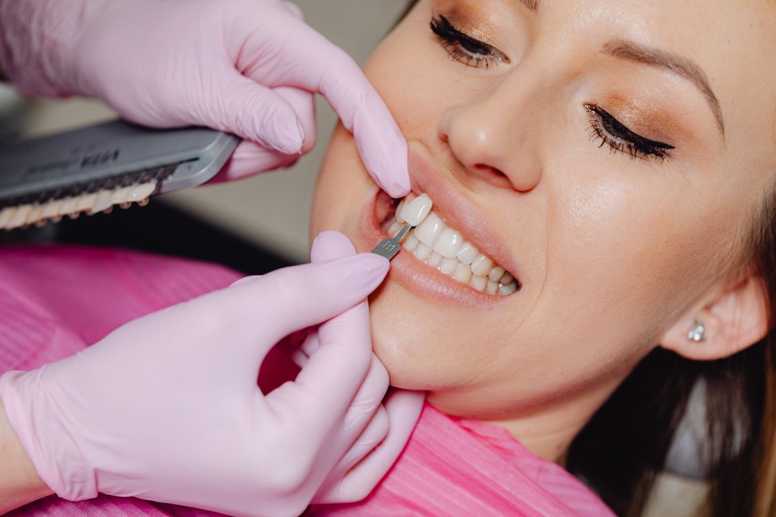 Dentist applying a porcelain veneer to a patient's front tooth
