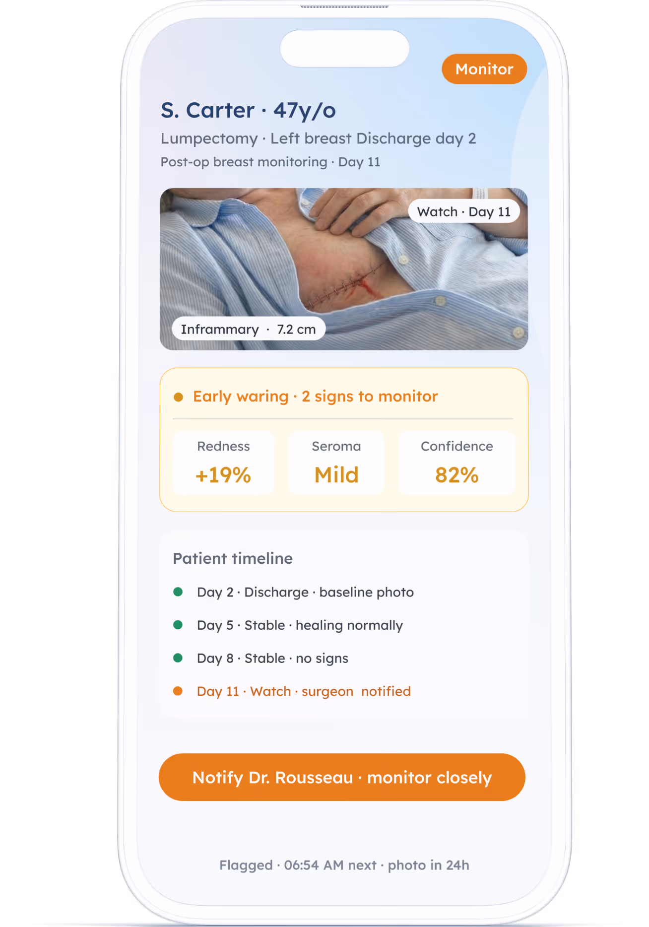 Pixacare AI-powered wound care platform – ePRO patient-reported outcomes and wound tracking
