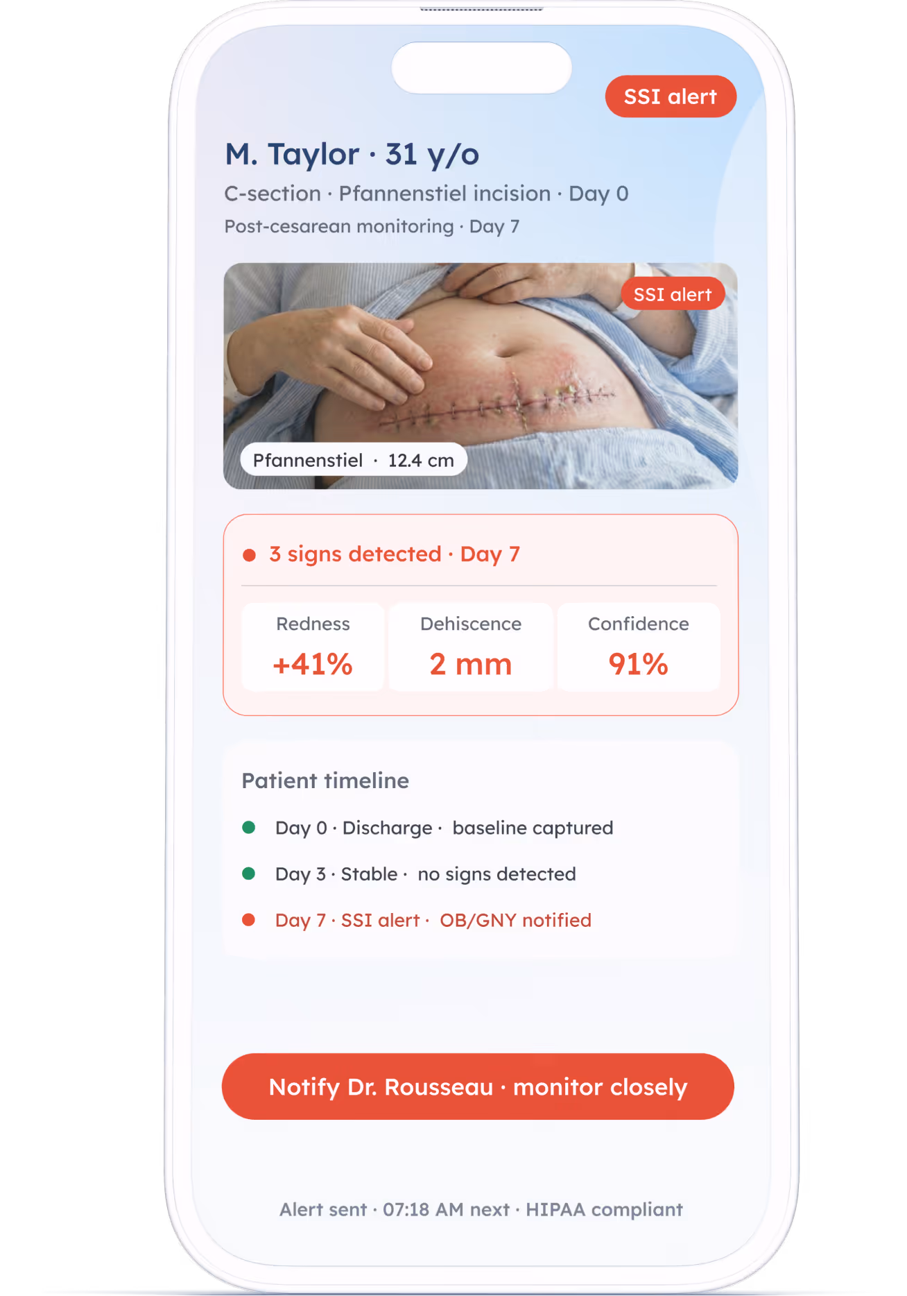Pixacare AI wound care app – automated wound documentation and clinical reporting screen