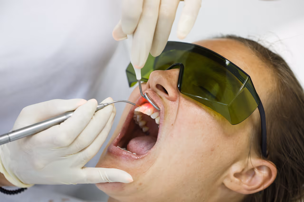 Laser Dentistry