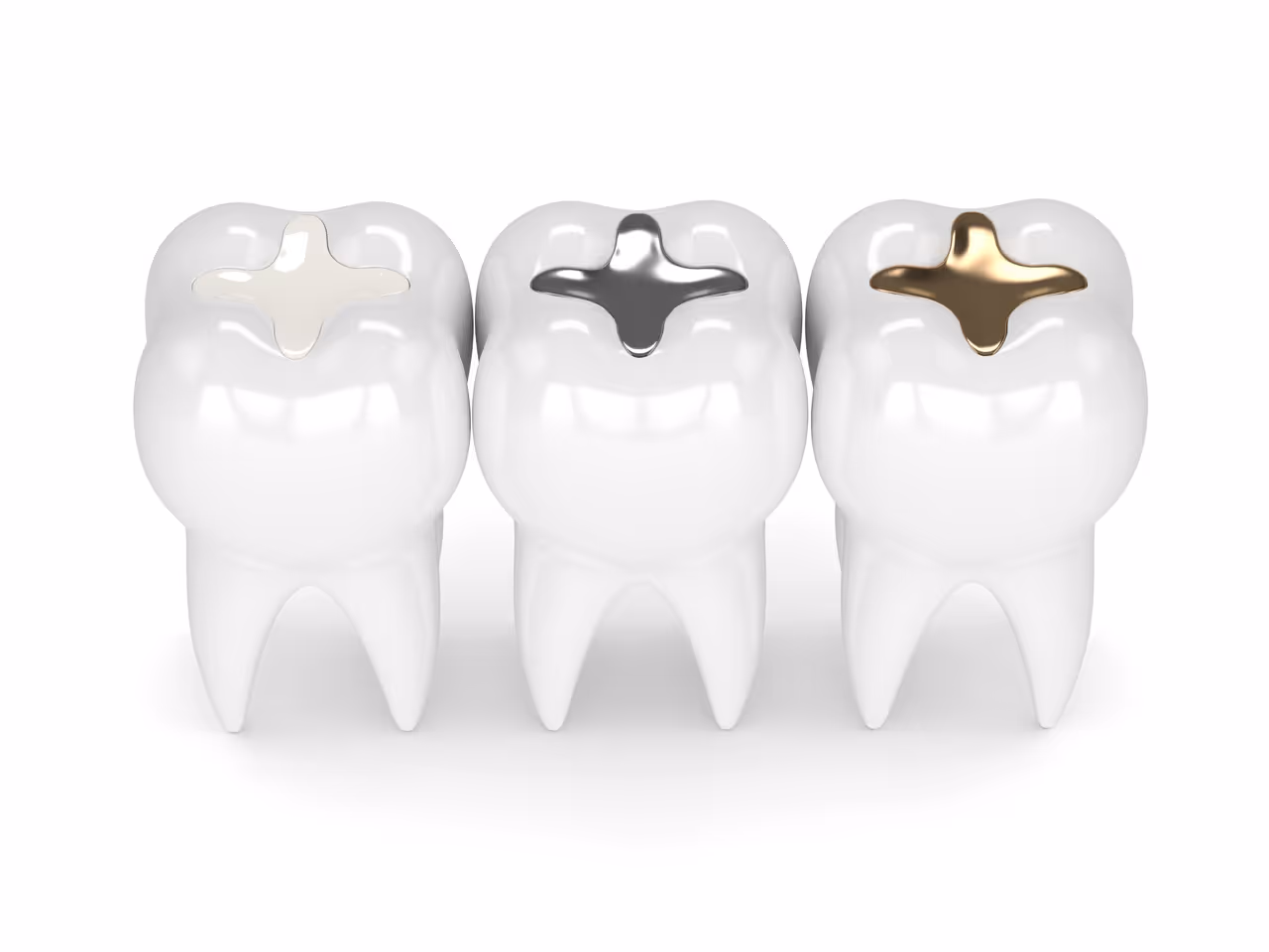 Metal Crowns vs. Porcelain Dental Crowns