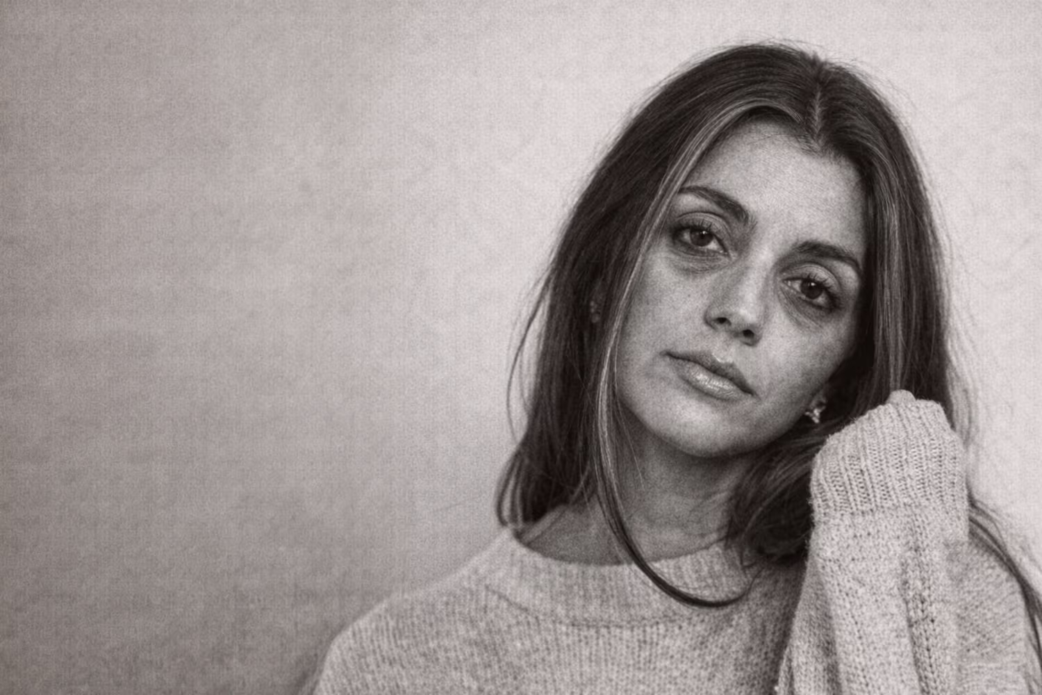 Black and white portrait representing under-eye hollows and tear trough shadowing concern at CAMI