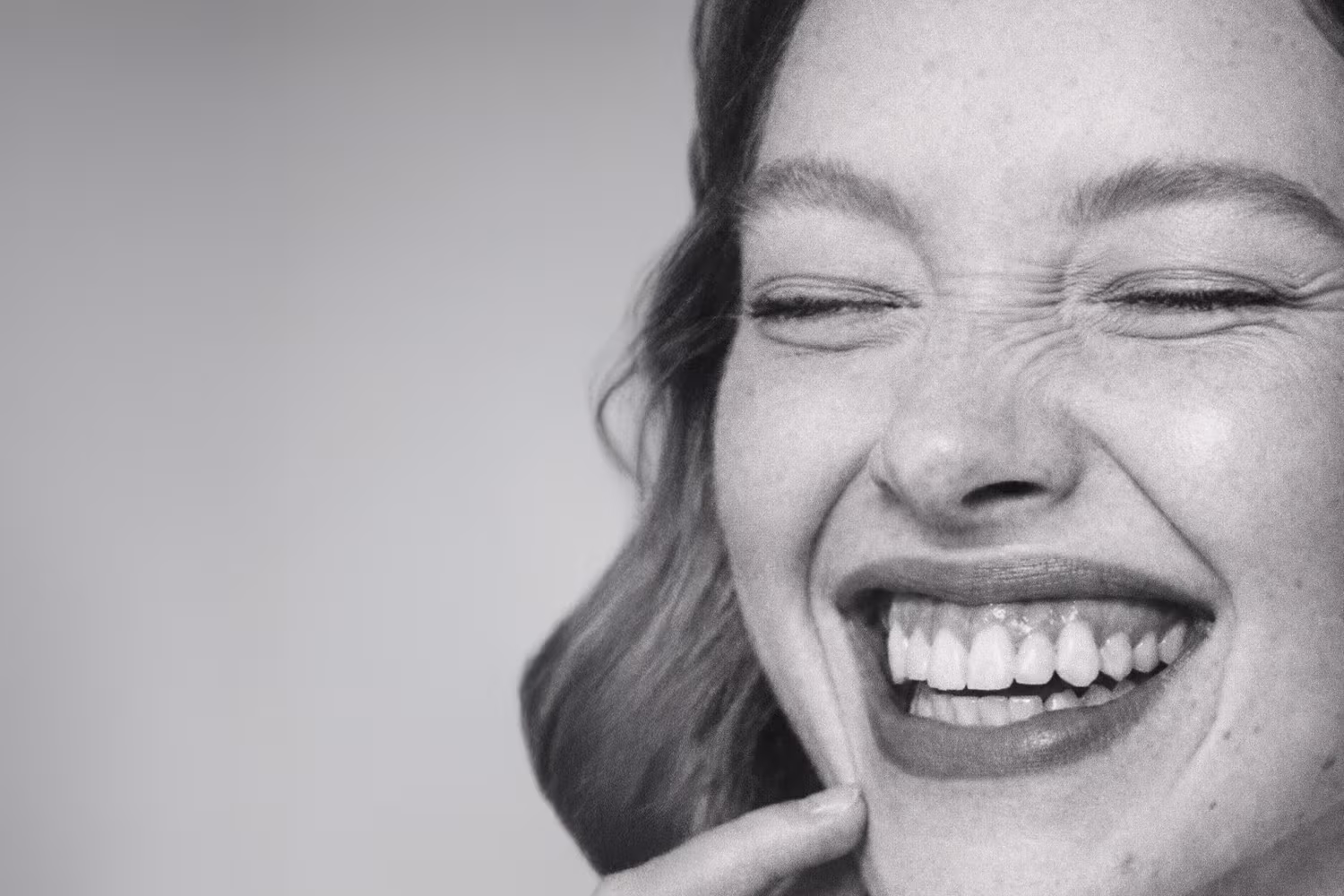 Black and white portrait representing gummy smile concern showing excess gum visibility at CAMI
