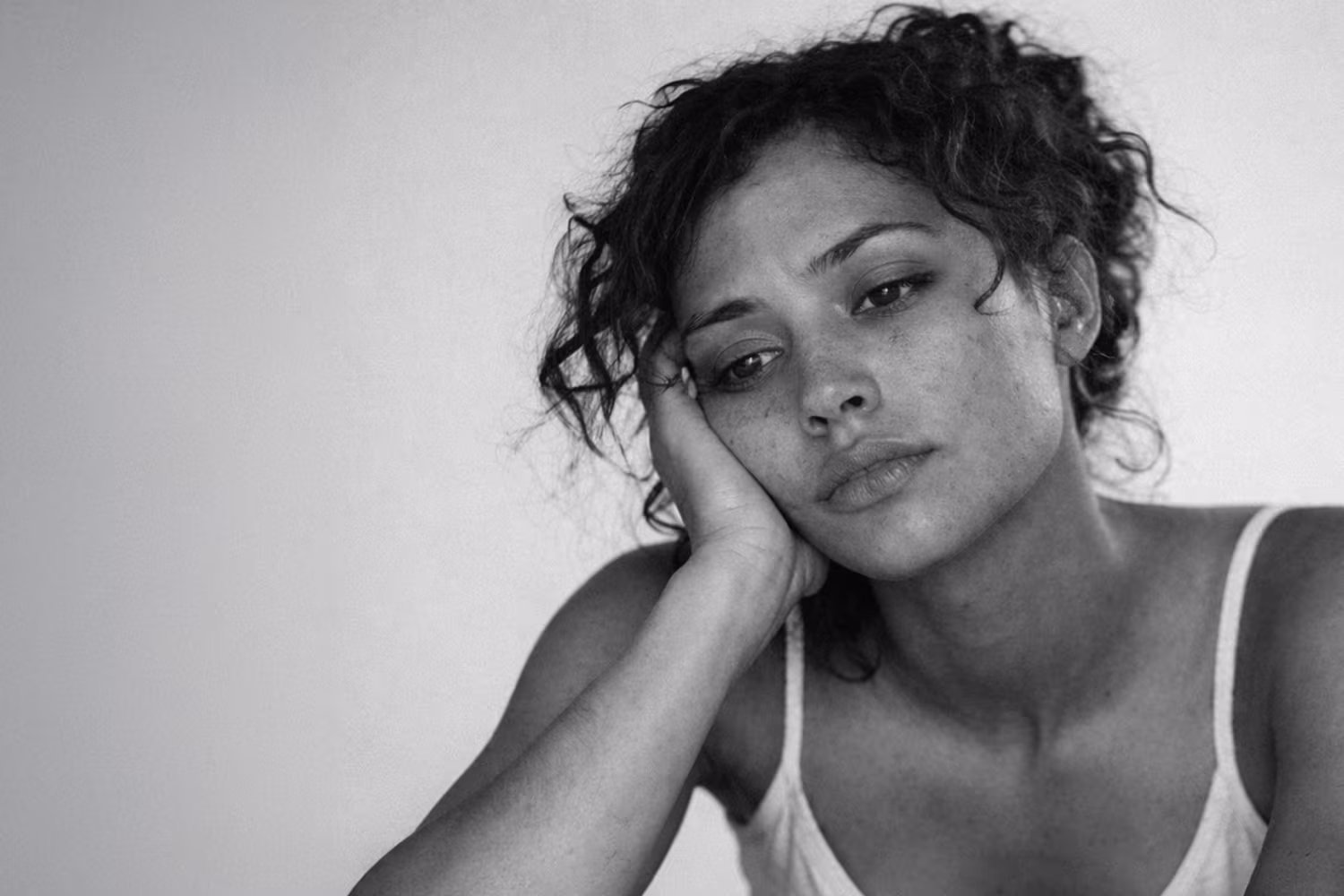 Black and white portrait representing vitamin deficiency and nutritional concern at CAMI