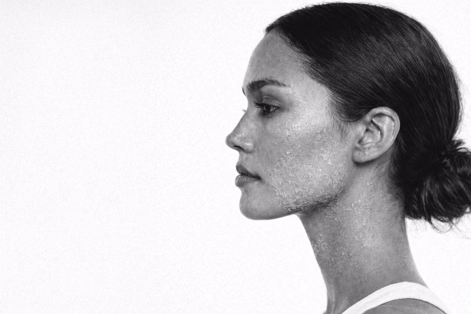 Black and white portrait representing dry and flaky skin dehydration concern at CAMI