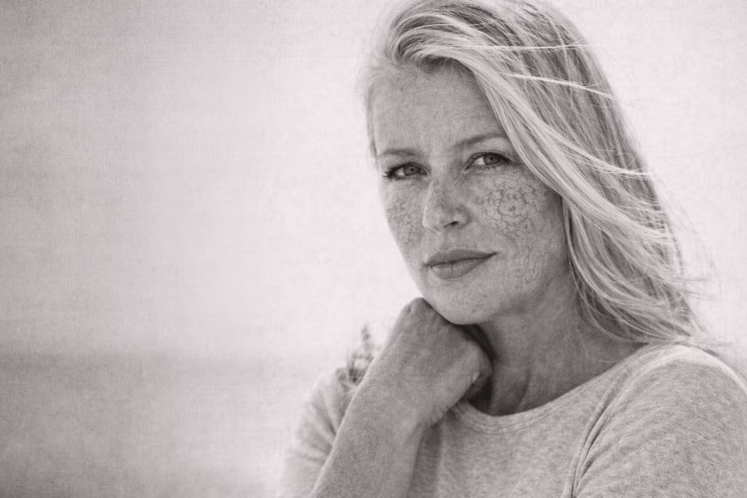 Black and white close-up representing broken capillaries and visible facial redness concern at CAMI