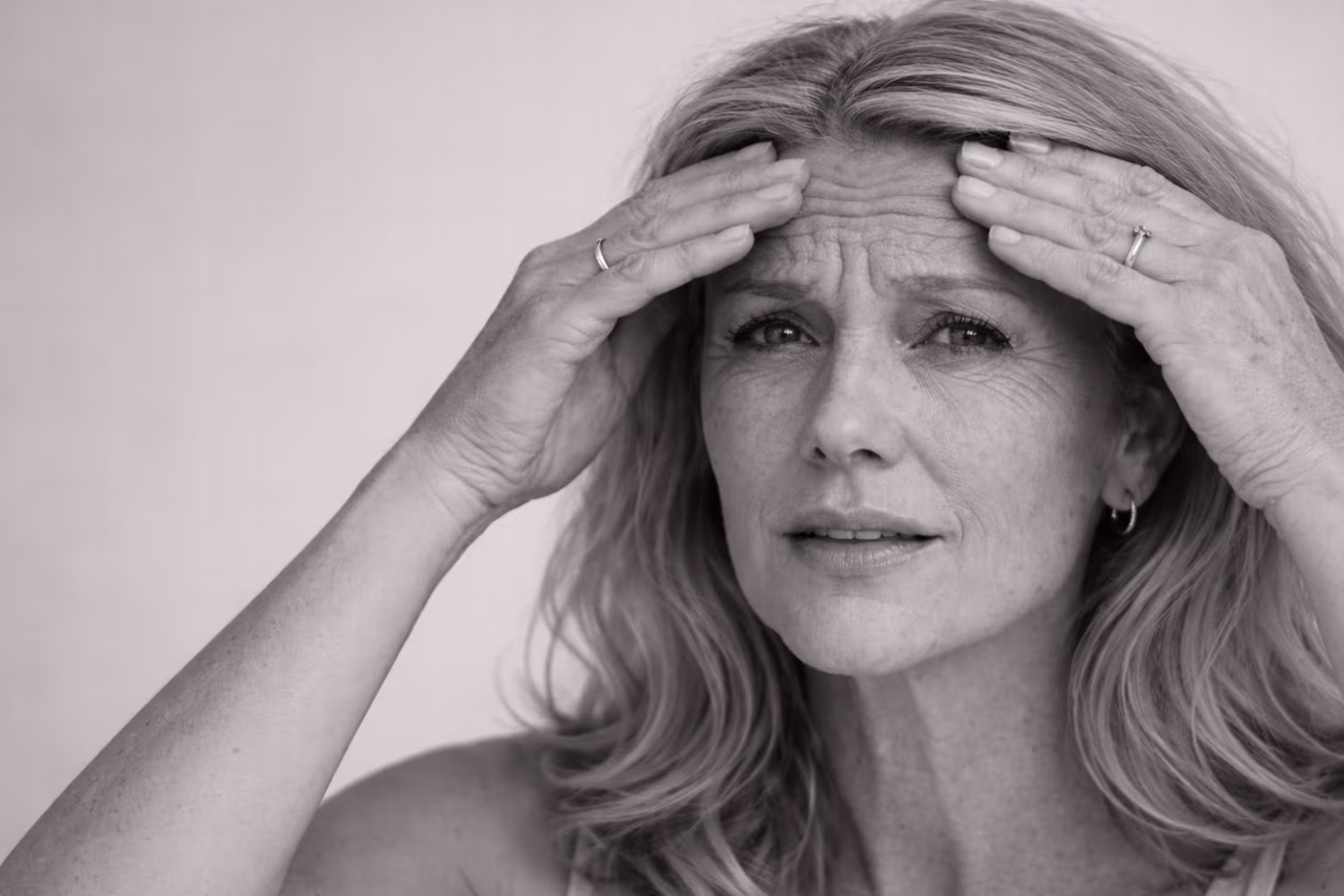 Black and white portrait representing deep lines and structural facial creasing concern at CAMI