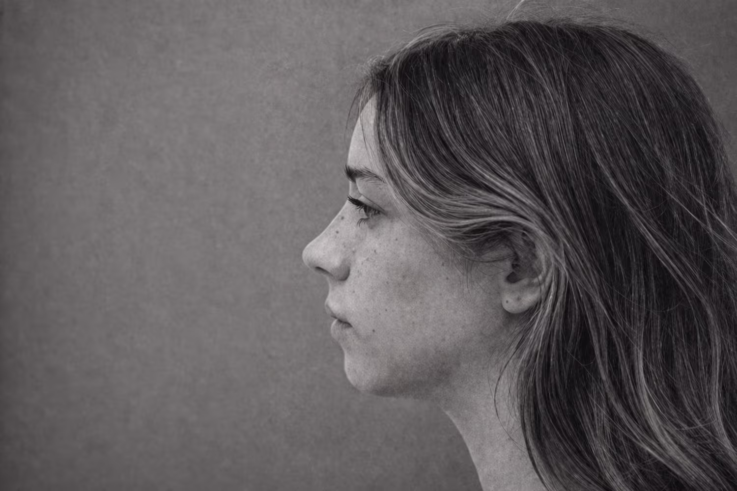 Black and white portrait representing weak chin and undefined jawline structural concern at CAMI