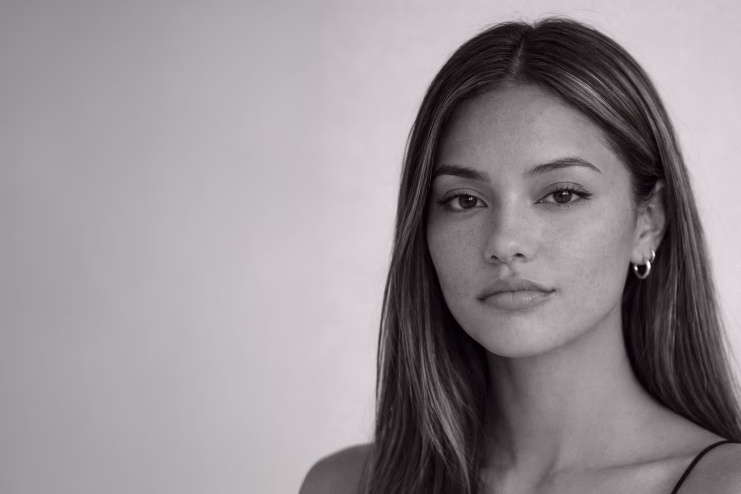 Black and white portrait representing asymmetrical lips and lip proportion imbalance concern at CAMI