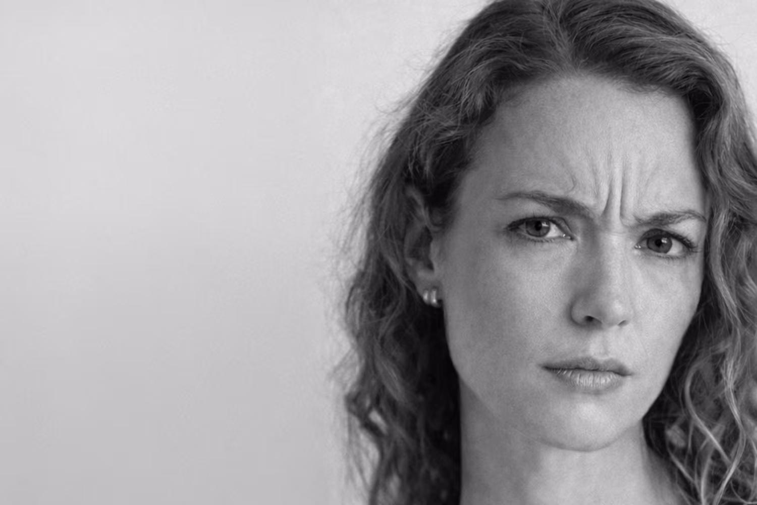 Black and white portrait showing frown lines and 11s between the brows concern at CAMI