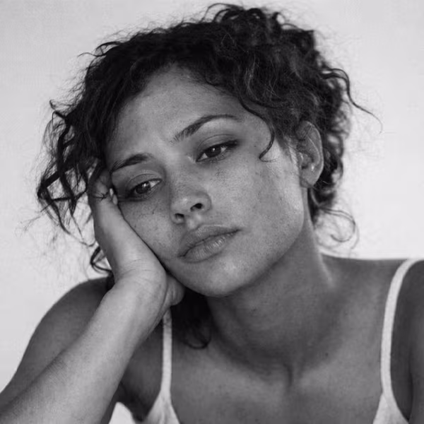 Black and white portrait representing vitamin deficiency and nutritional concern at CAMI