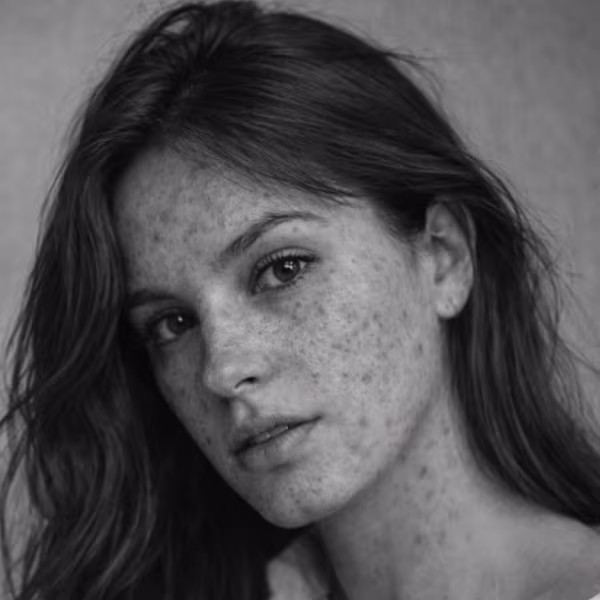 Black and white close-up representing acne scarring and post-inflammatory texture concern at CAMI
