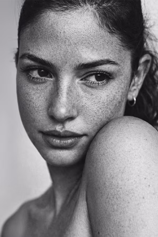 Black and white close-up portrait representing rough skin texture concern at CAMI