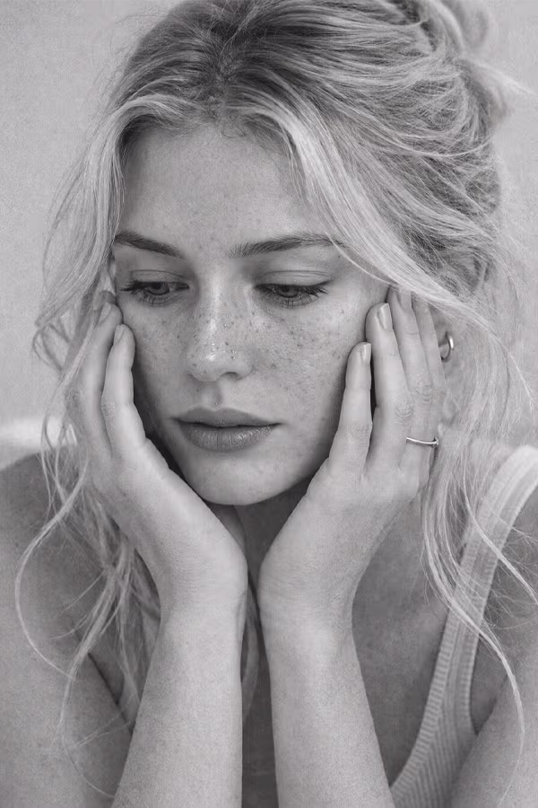 Black and white close-up representing blackheads and whiteheads clogged pore concern at CAMI