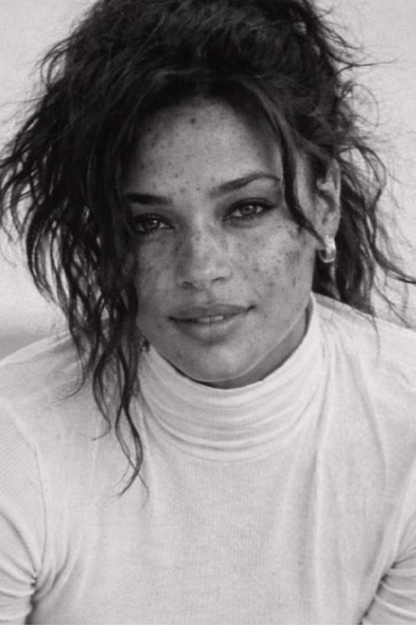 Black and white portrait representing hyperpigmentation and uneven skin discoloration concern at CAMI