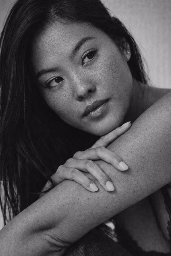 Black and white close-up representing enlarged pores and congested skin concern at CAMI