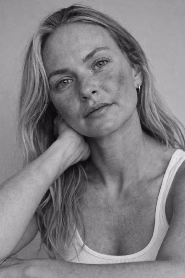 Black and white portrait representing rosacea and chronic facial redness concern at CAMI