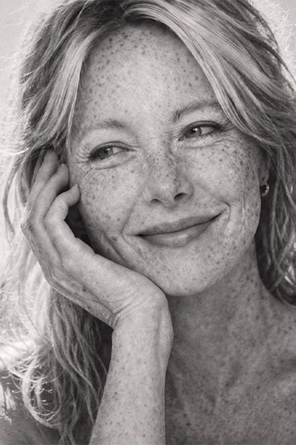 Black and white portrait representing sun spots and age spot pigmentation concern at CAMI
