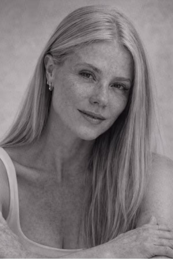 Black and white portrait representing overall facial aging and volume loss concern at CAMI