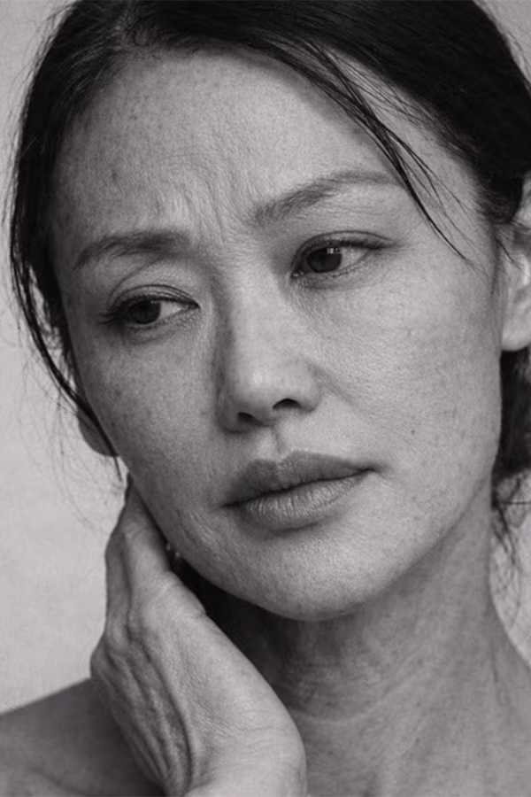 Black and white portrait representing skin thinning and loss of dermal density concern at CAMI