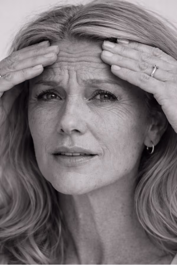 Black and white portrait representing deep lines and structural facial creasing concern at CAMI