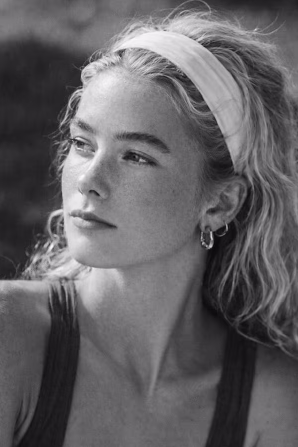 Black and white portrait representing thin lips and loss of lip volume concern at CAMI