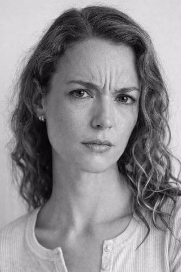 Black and white portrait showing frown lines and 11s between the brows concern at CAMI