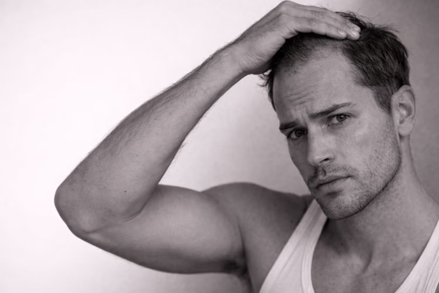 Black and white portrait representing male hair loss and thinning hairline concern at CAMI