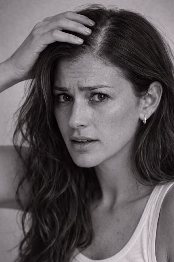 Black and white portrait representing female hair loss and thinning concern at CAMI