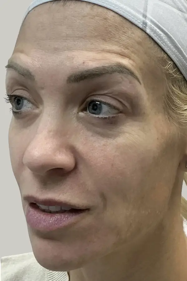 katie-fullface