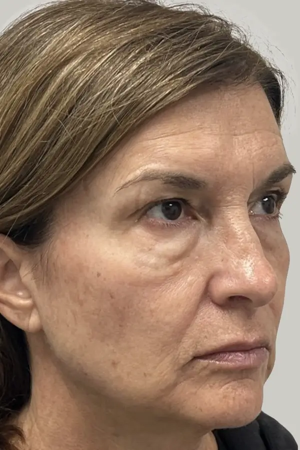 katie-fullface