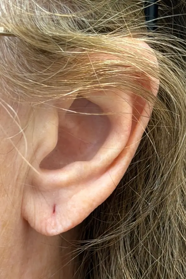 katie-earlobe