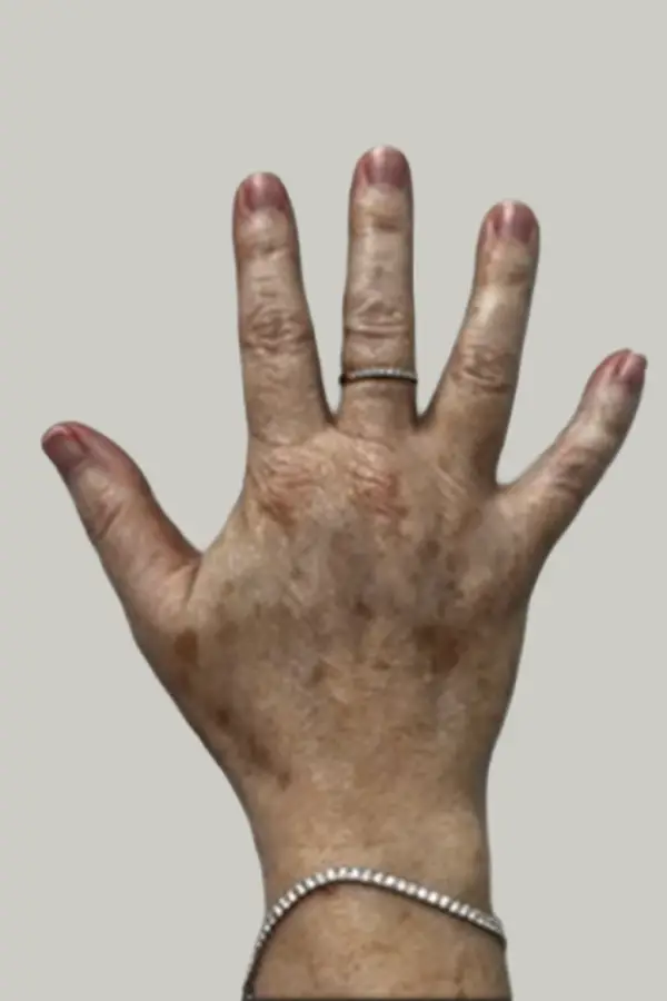 meredith-hand