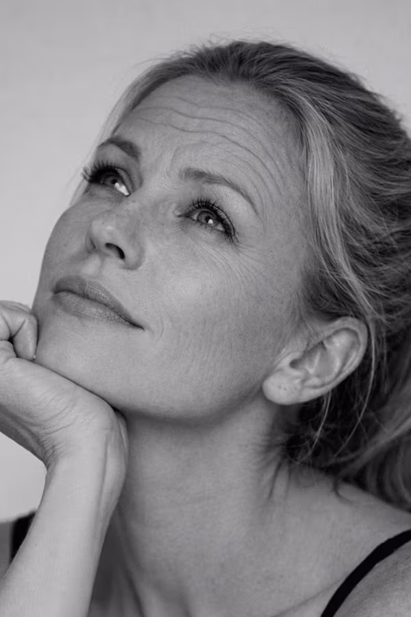 Black and white portrait representing forehead wrinkles and horizontal expression lines concern at CAMI