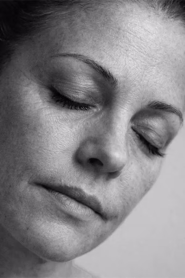 Black and white portrait representing fine lines and wrinkles aging concern at CAMI