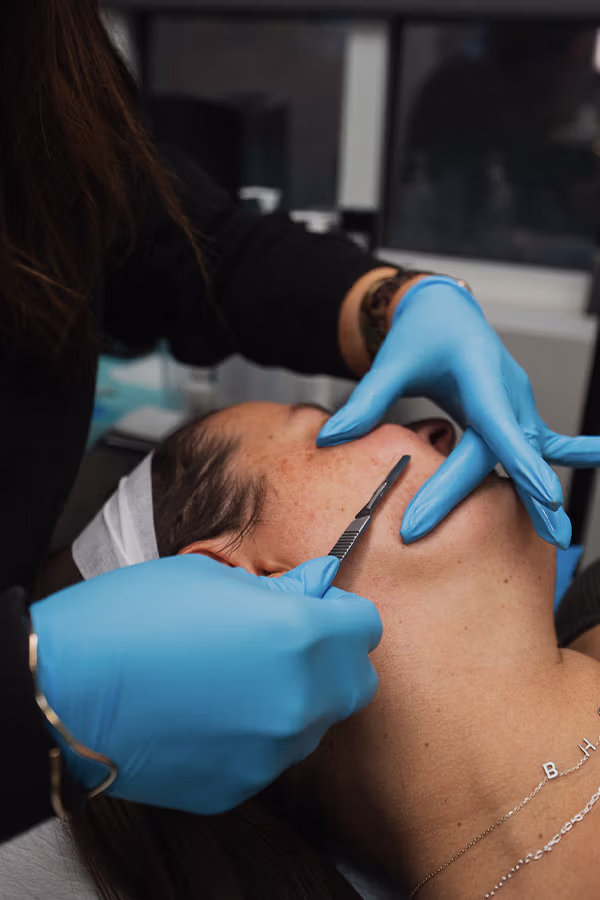 CAMI provider performing dermaplaning treatment on patient's face