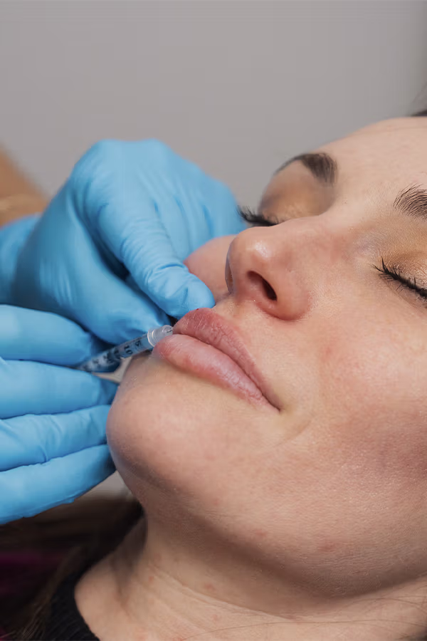 CAMI provider administering lip filler injection to patient